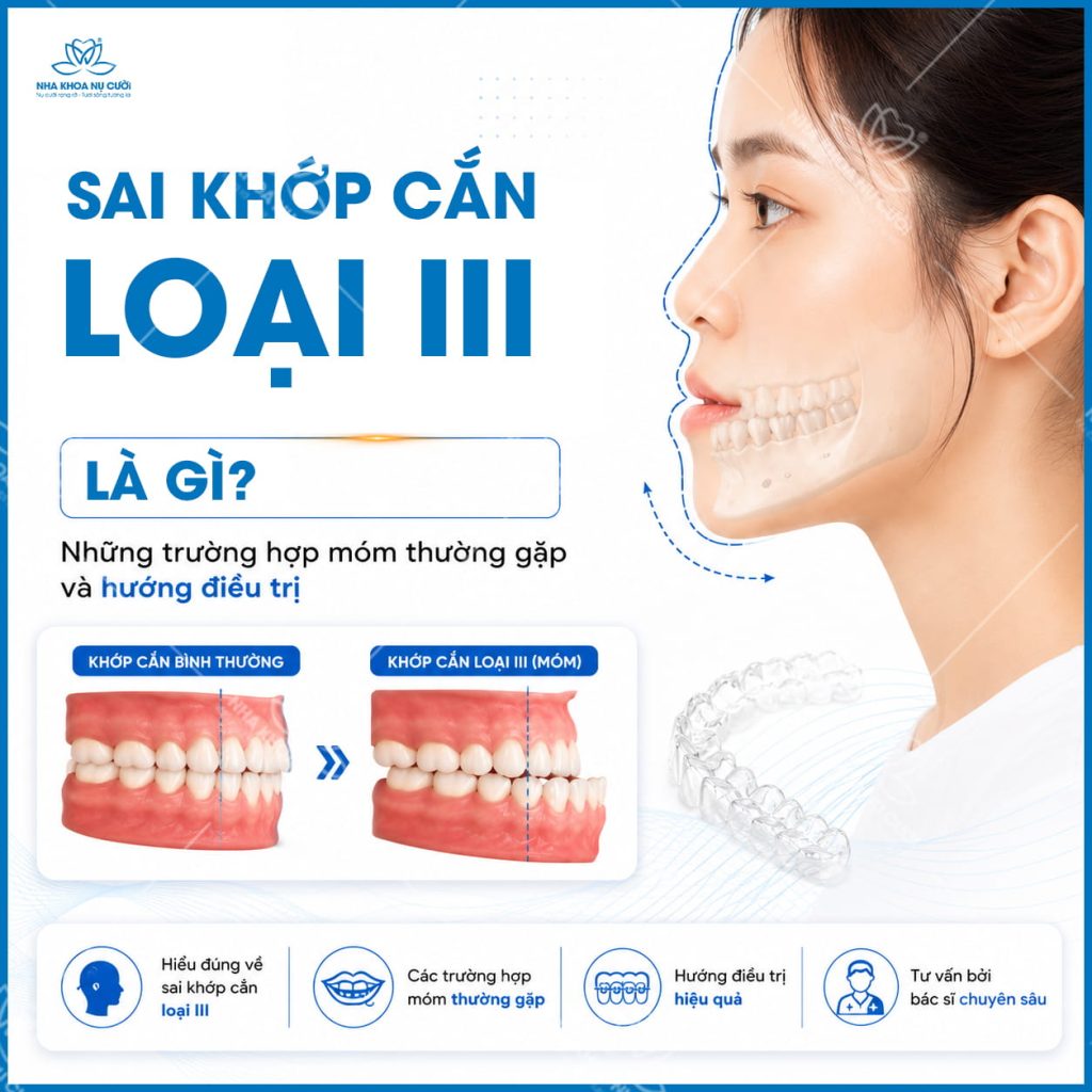 sai-khop-can-loai-III-hai-phong