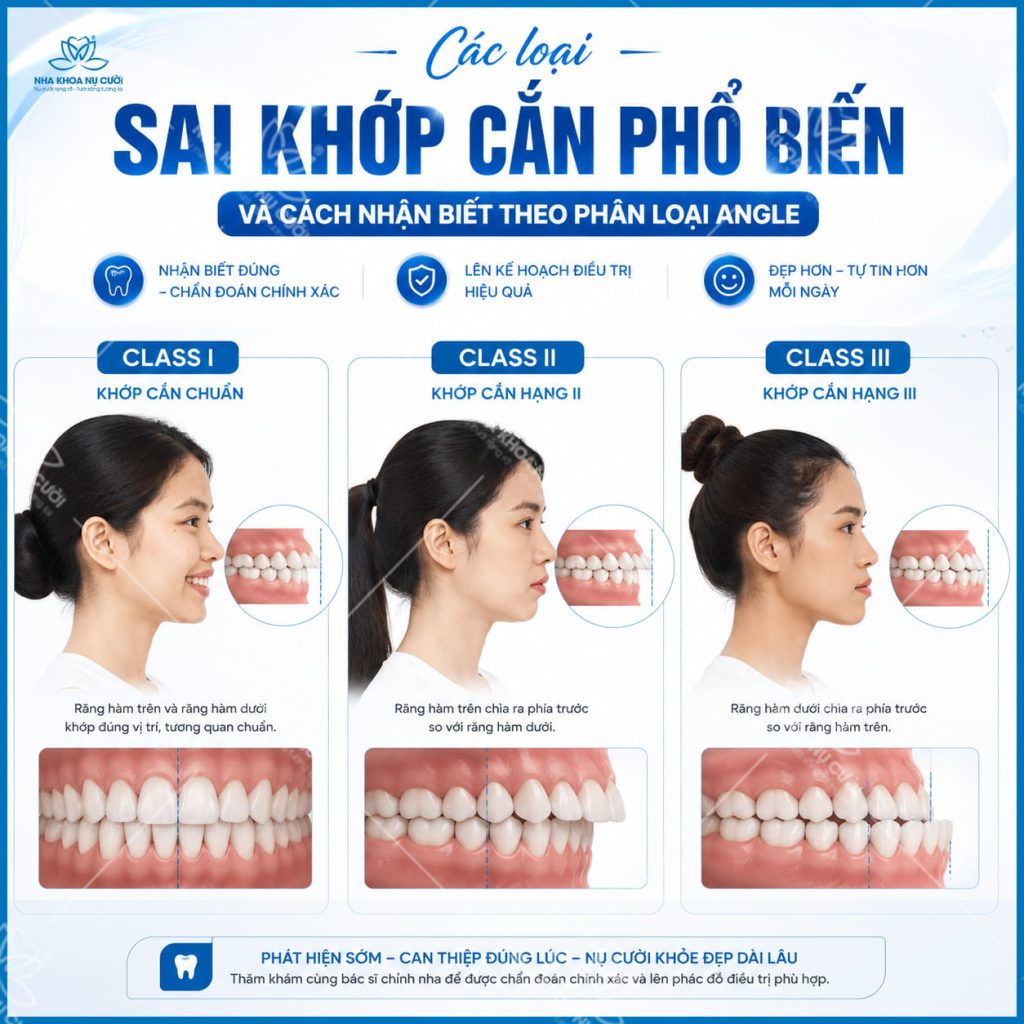 cac-loai-sai-khop-can-theo-angle