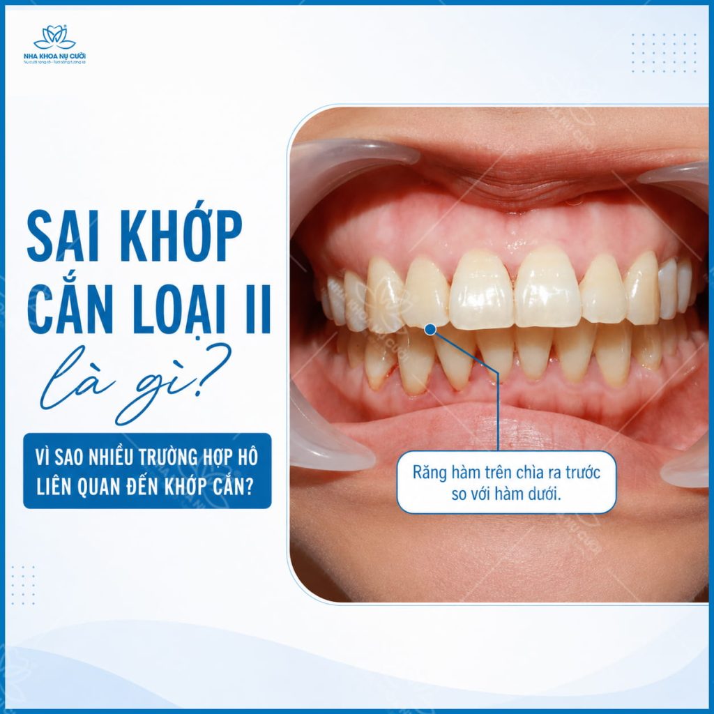 sai-khop-can-loai-II