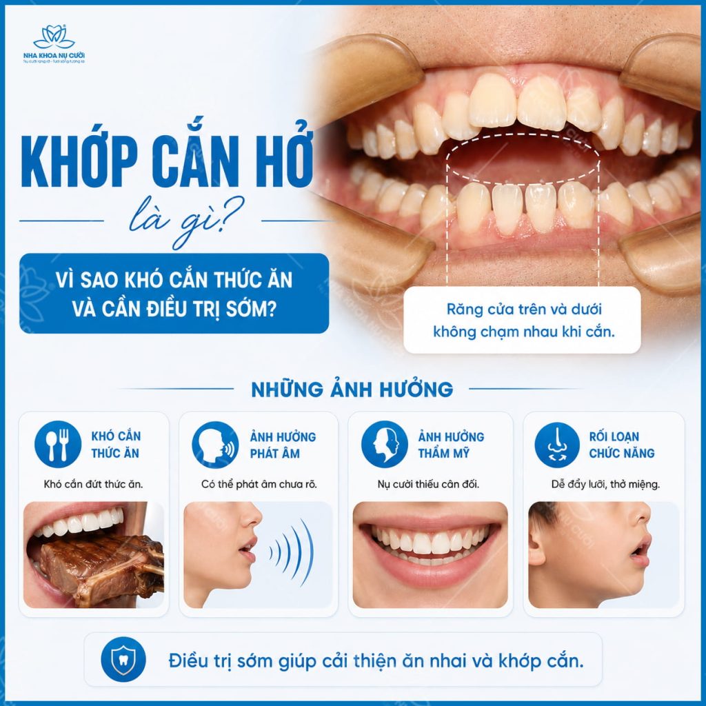 khop-can-ho-hai-phong
