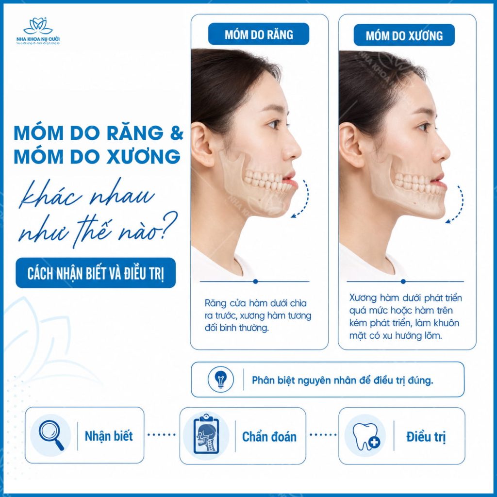 mom-do-rang-va-mom-do-xuong-hai-phong