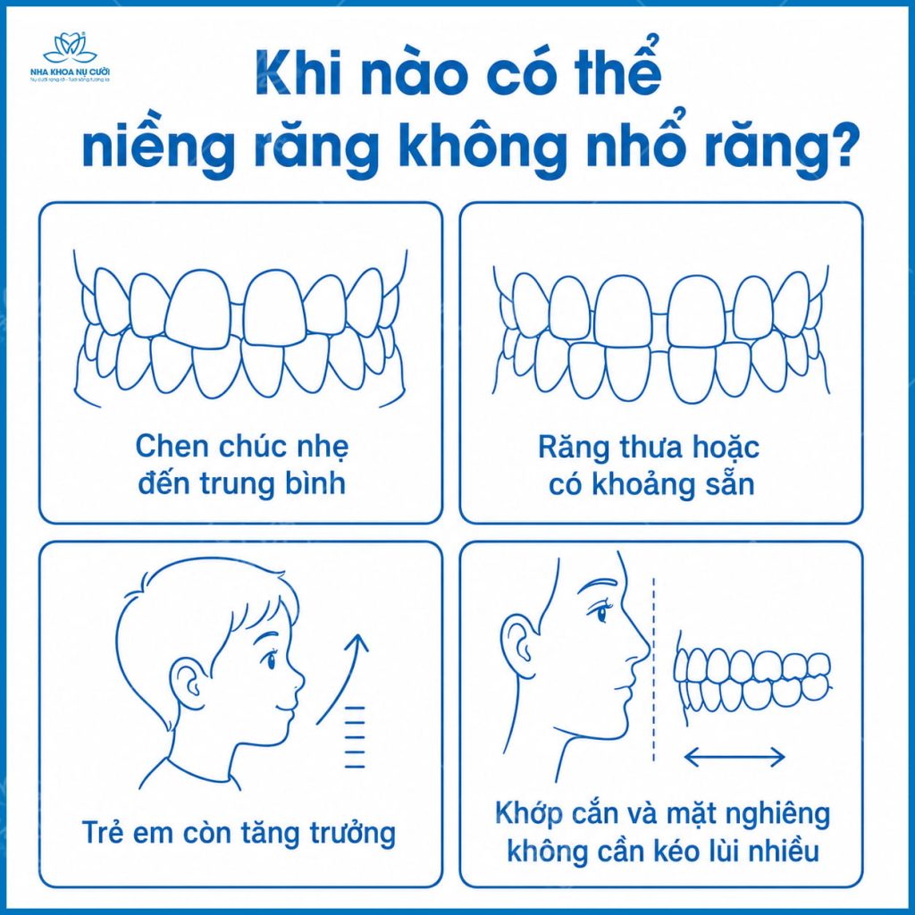 truong-hop-khong-can-nho-rang-trong-chinh-nha