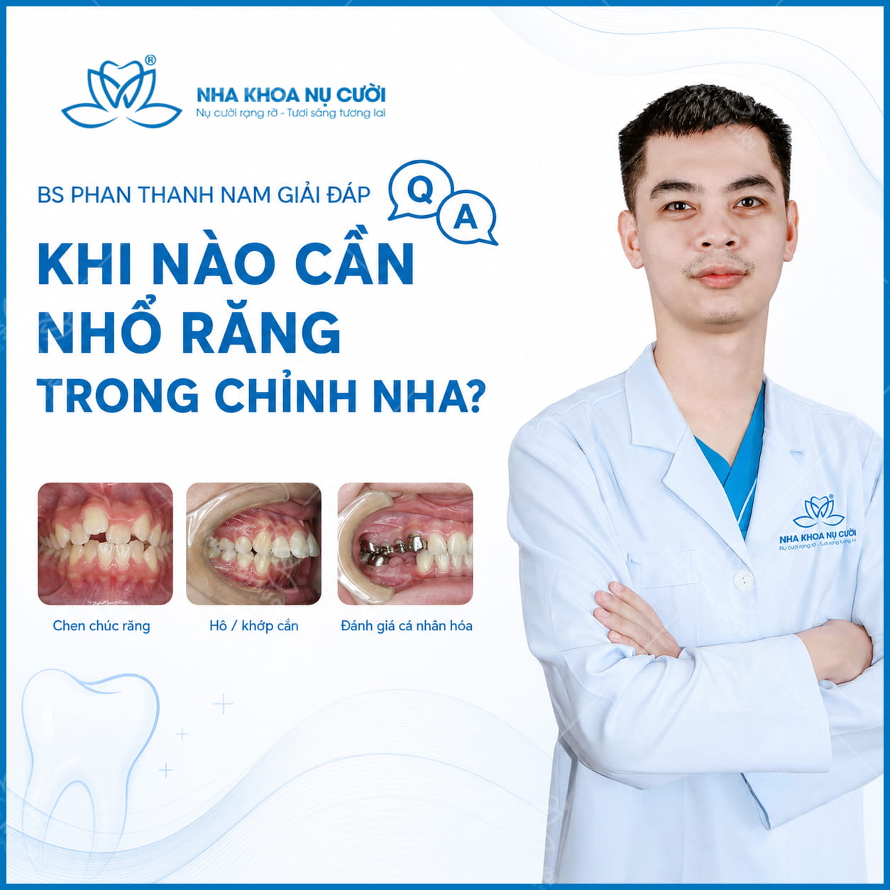 BS Phan Thanh Nam giải đáp: Khi nào cần nhổ răng trong chỉnh nha?
