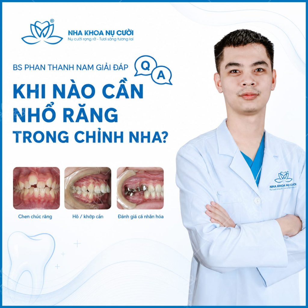 nho-rang-trong-chinh-nha