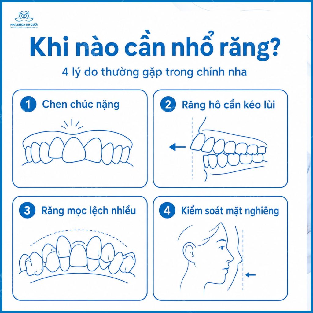 truong-hop-can-nho-rang-trong-chinh-nha