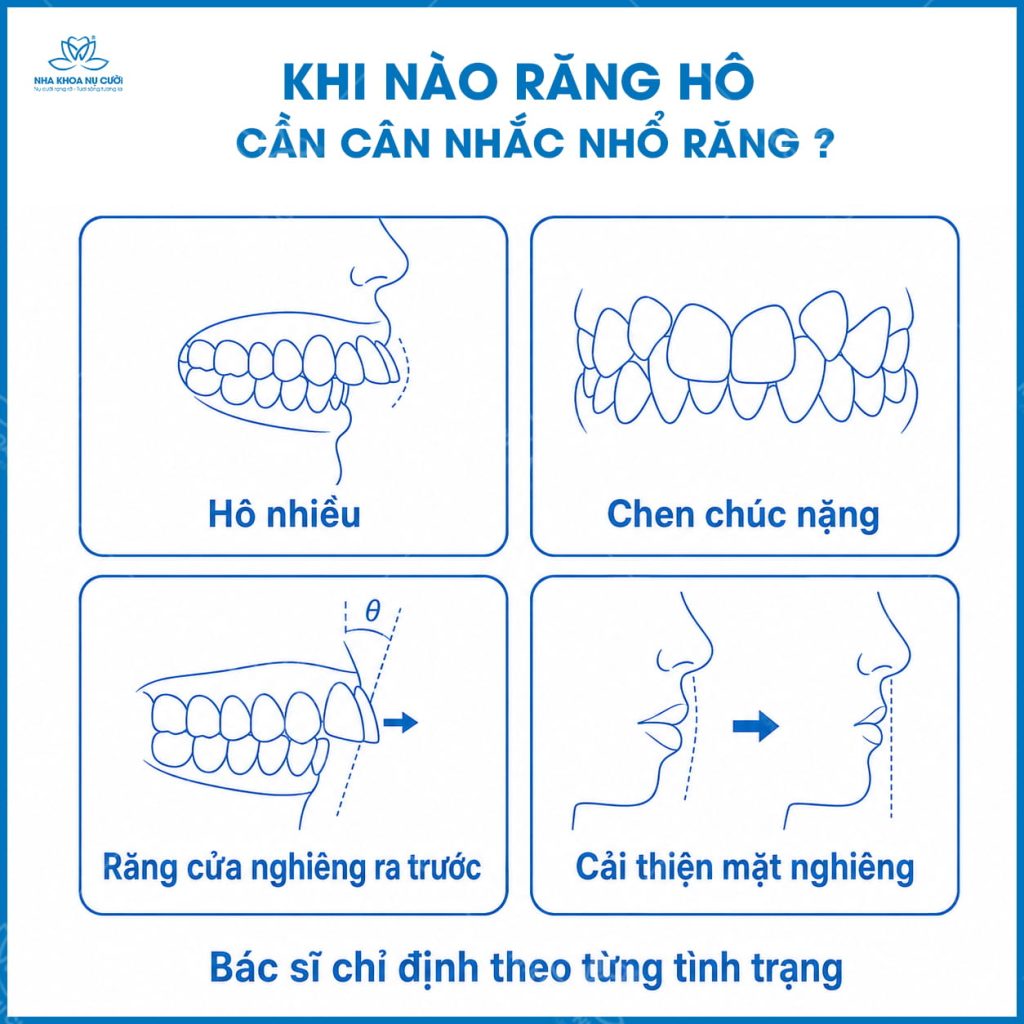 ho-nao-cung-can-nho-rang