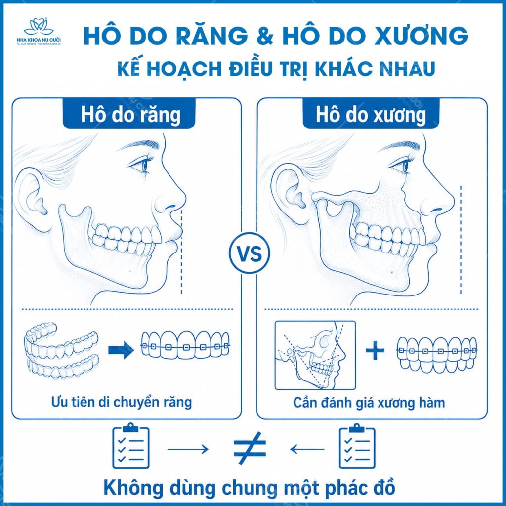 ho-do-rang-ho-do-xuong