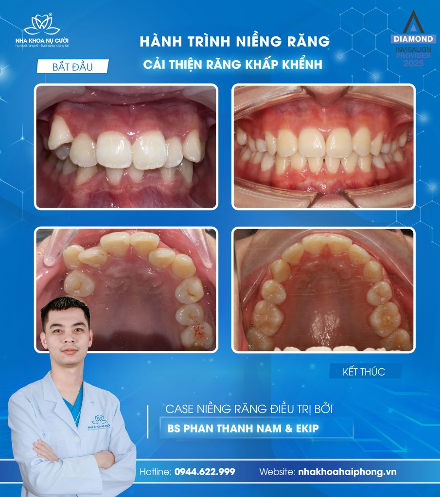ket-thuc