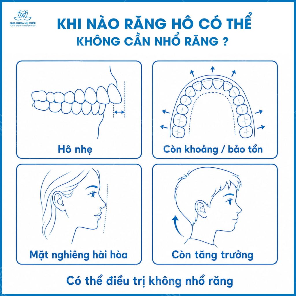 ho-nao-cung-can-nho-rang