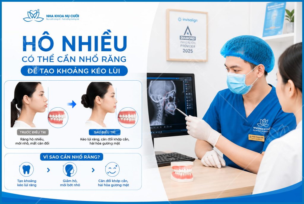 ho-nhieu-can-nho-rang