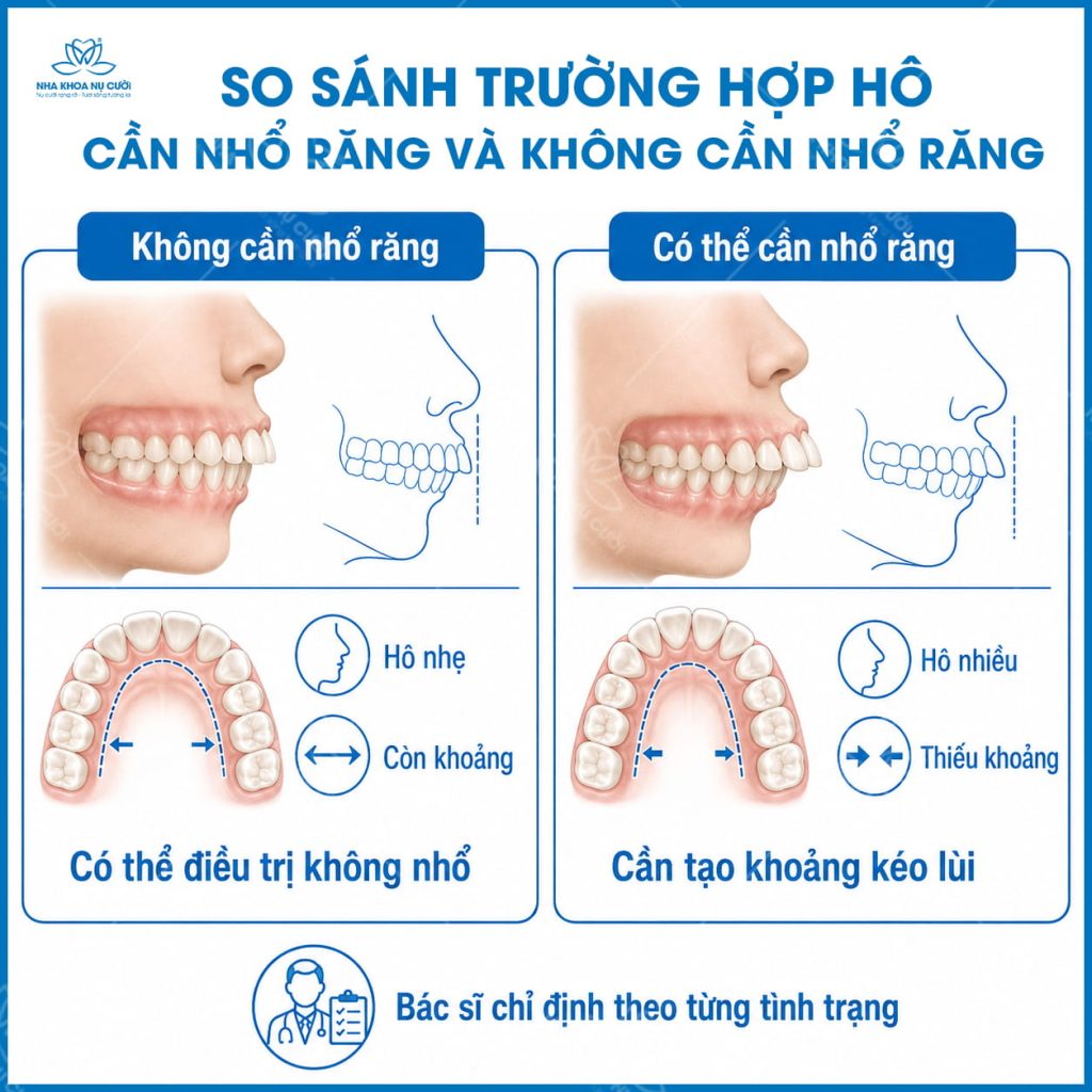 so-sanh