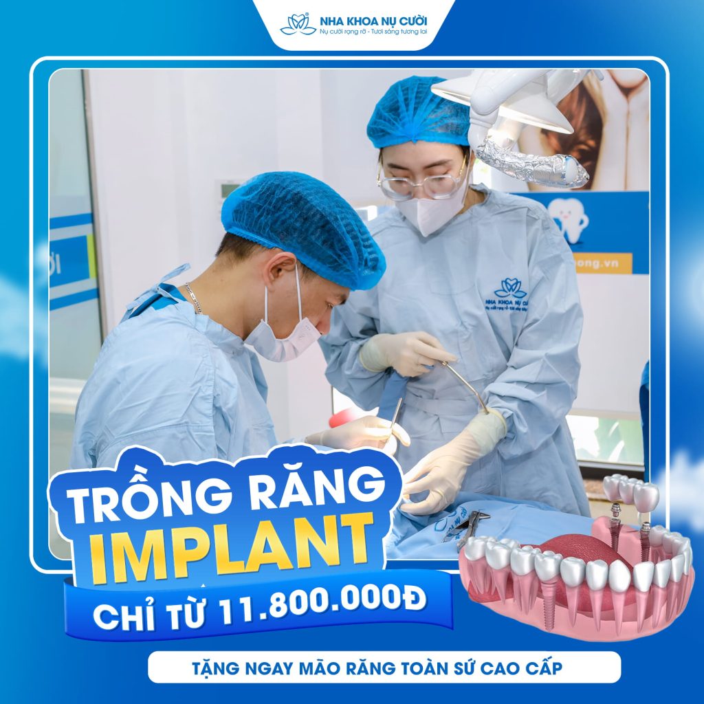 uu-dai-nha-khoa-thang-8-trong-rang-implant