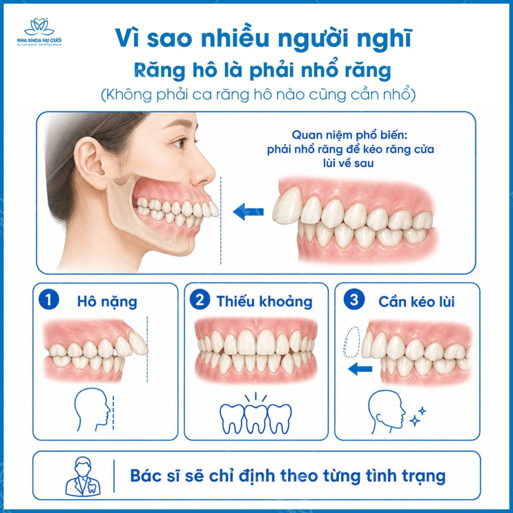 ho-nao-cung-can-nho-rang
